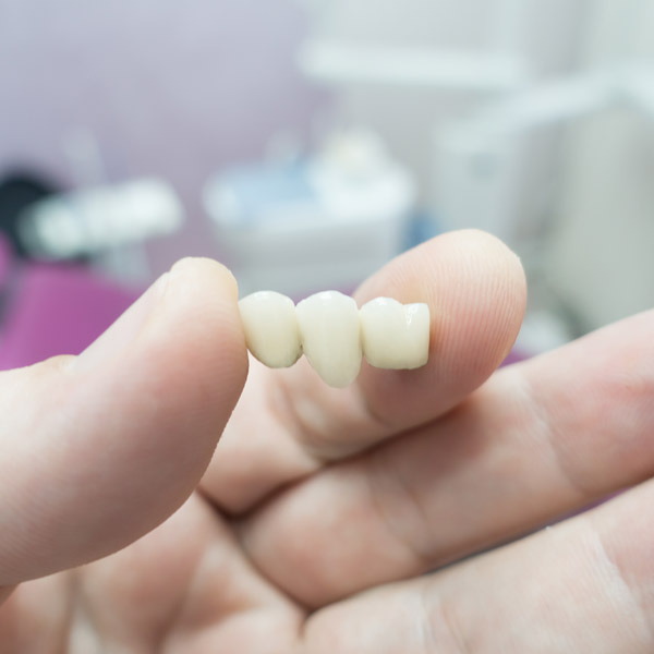dental bridge in hand